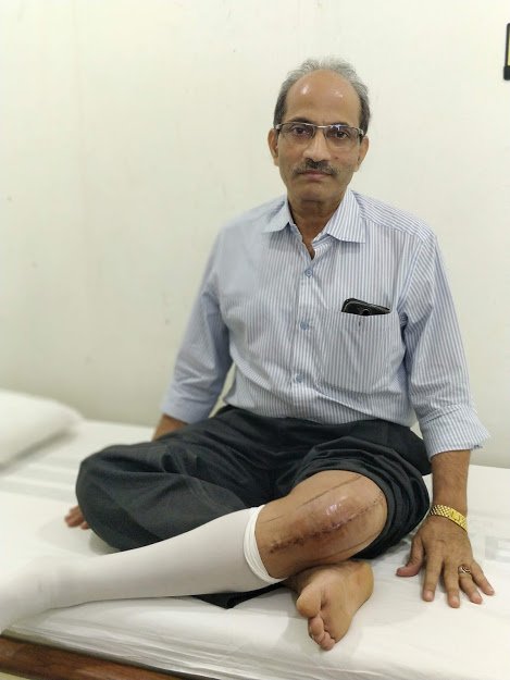 Knee Replacement Surgery in thane