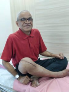 Knee Replacement Surgery in thane