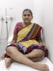 Best Knee Replacement Surgery center in thane