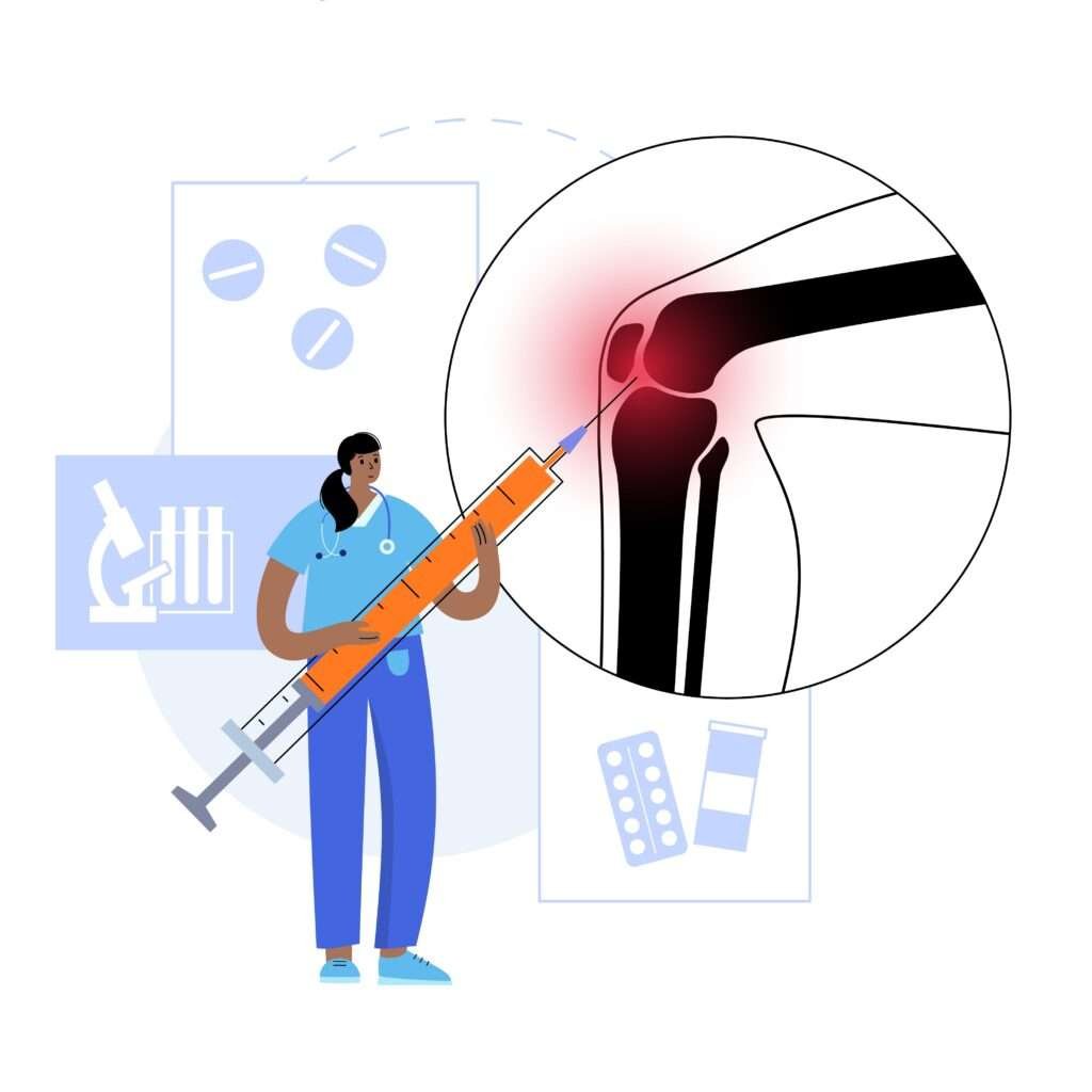 Platelet-rich plasma (PRP) Injection for Early Knee Osteoarthritis - Result