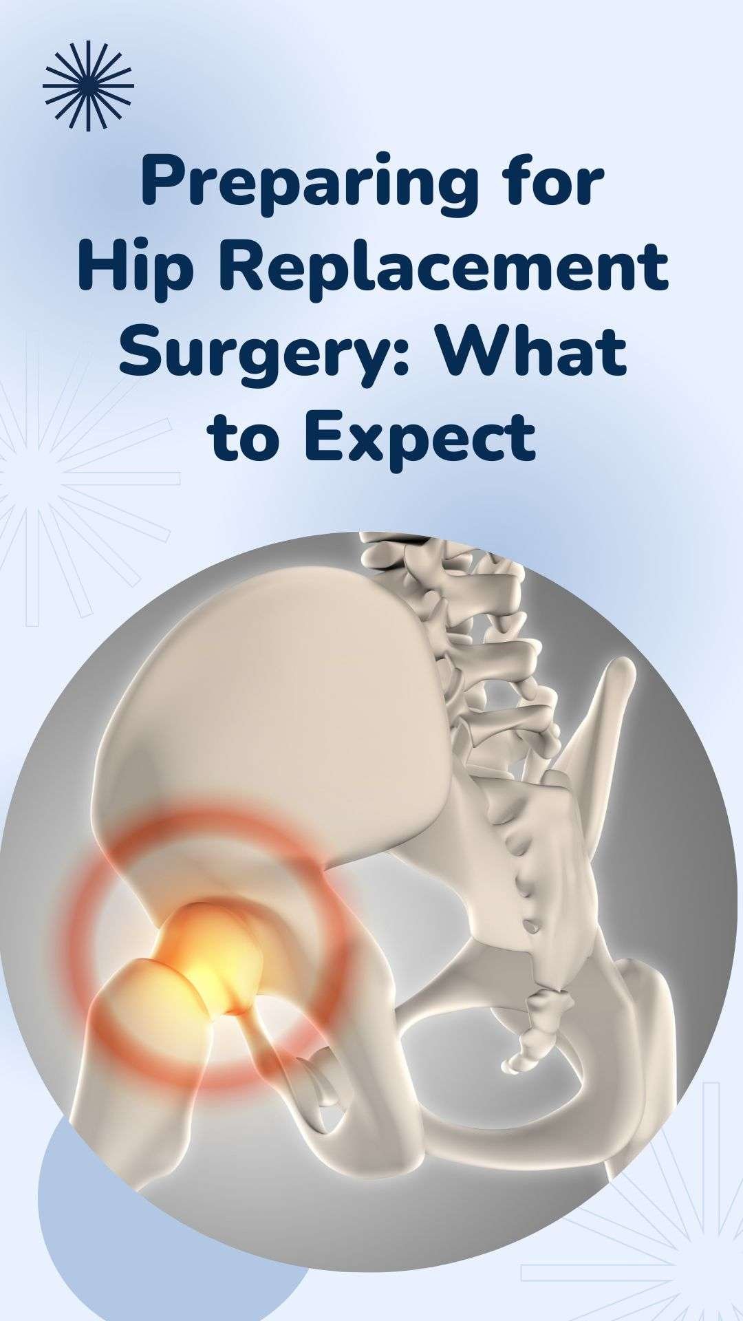 Preparing for Hip Replacement Surgery: What to Expect
