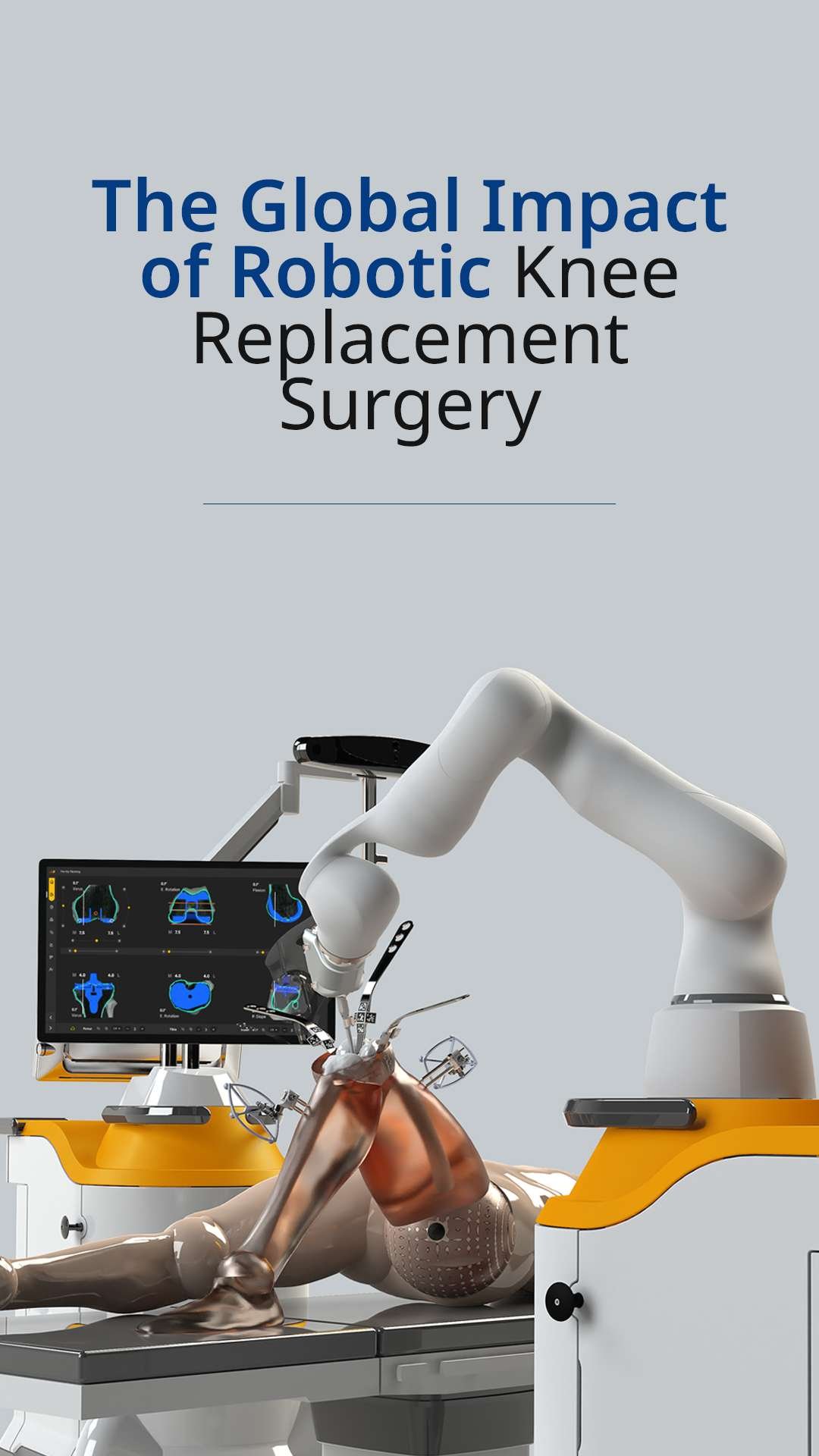The Global impact of Robotic knee surgery