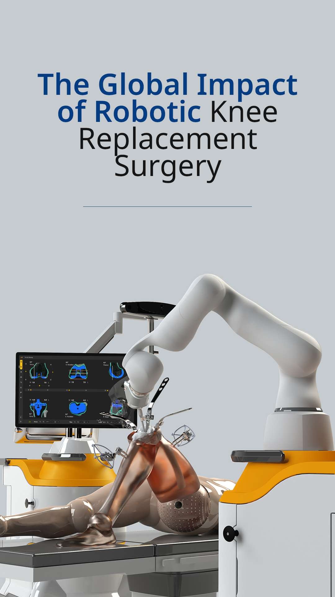 the-global-impact-of-robotic-knee-replacement-surgery