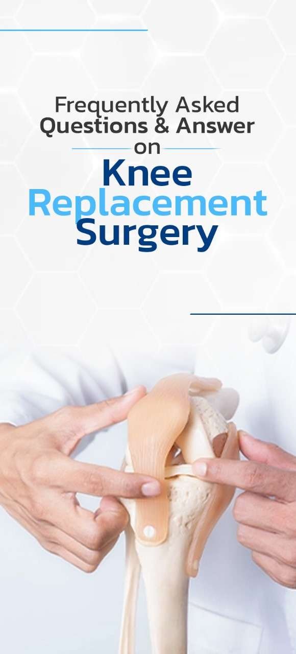 Frequently asked questions and answer on Knee Replacement surgery