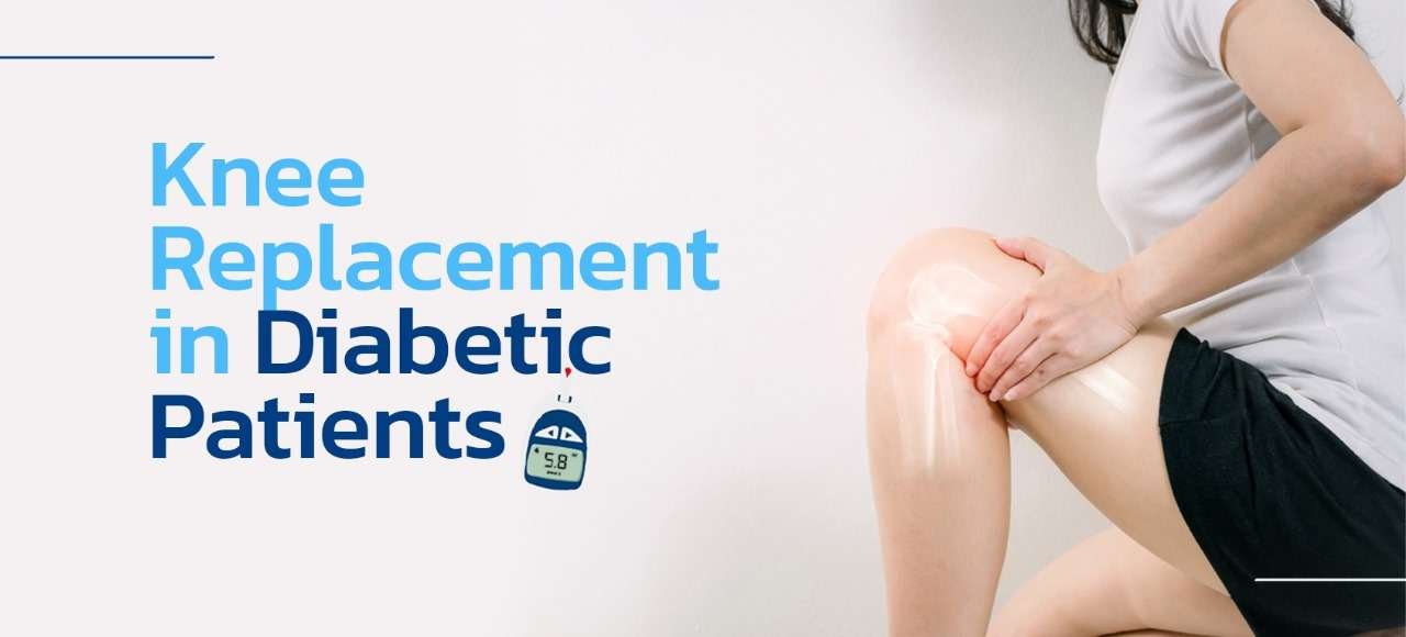 kNEE Repacemnt in diabetic patient