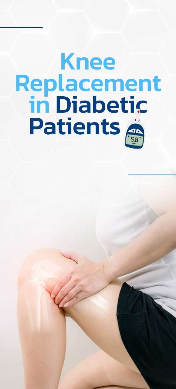 kNEE Repacemnt in diabetic patients