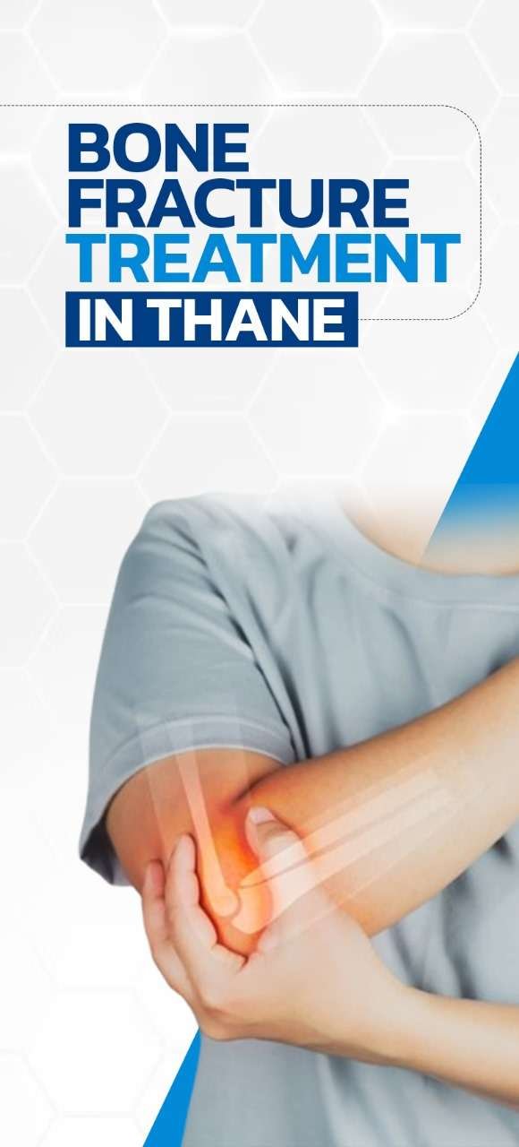 Bone Fracture Treatment Thane