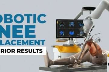 robotic knee surgery