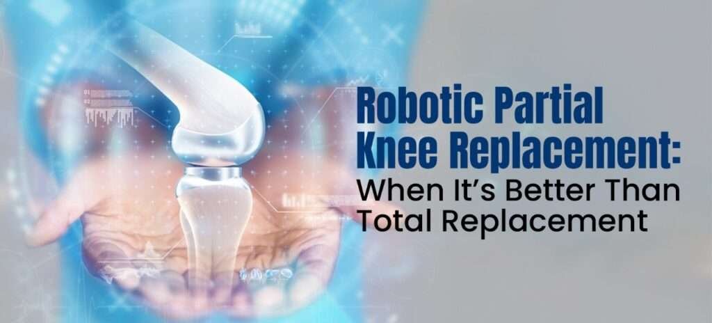 Robotic Partial Knee Replacement: When It’s Better Than Total Replacement