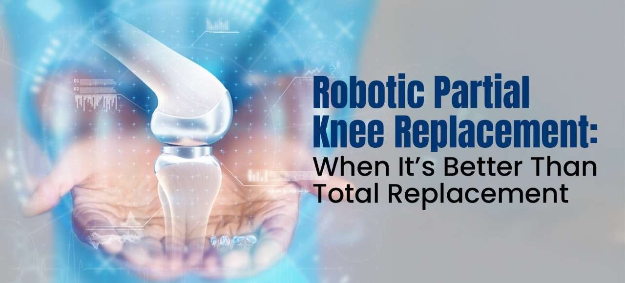 Robotic Partial Knee Replacement When It’s Better Than Total Replacement