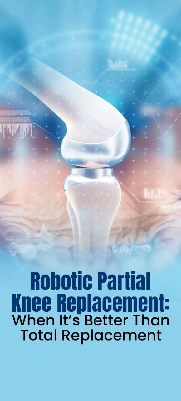 Robotic Partial Knee Replacement